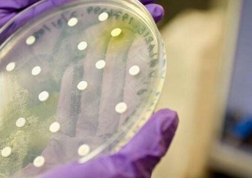 cultura bacteriana para diagnóstico de prostatite