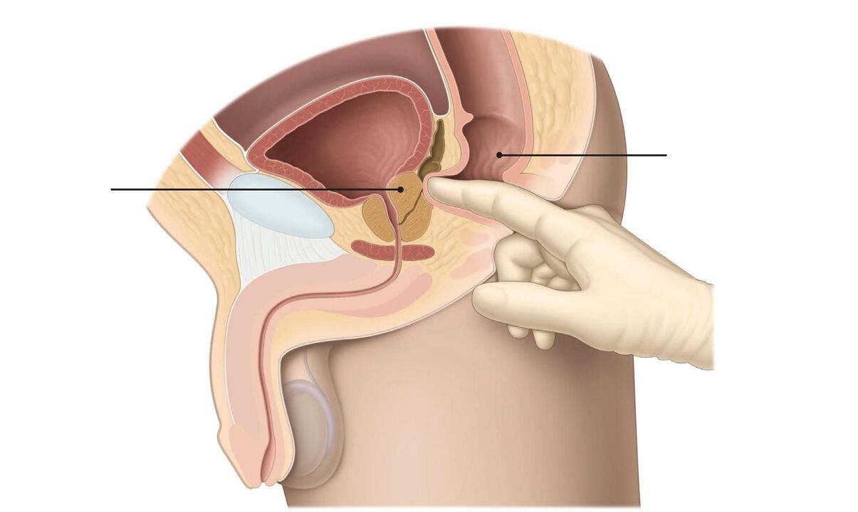 técnica de massagem de próstata
